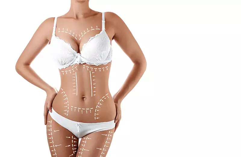 Anwendungsareale der Fettabsaugung: Gezielte Veränderungen für ein harmonisches Körperbild