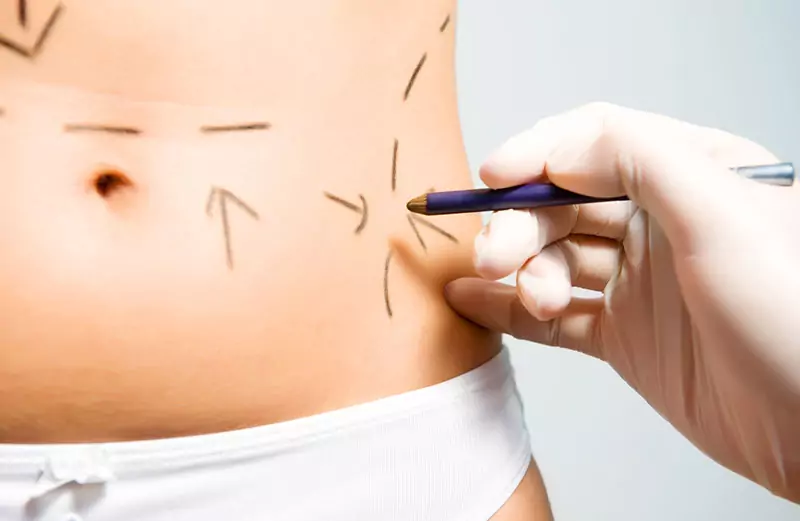 lipoaesthetic